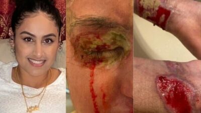 Help Nafiah, acid attack survivor, get justice