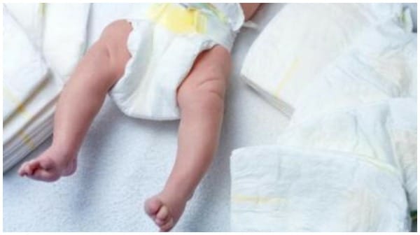 First Reported Case of Baby Born With Three Penises in Iraq - Vimarsana News