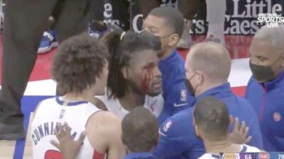 Isaiah Stewart (faced bloodied)