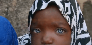 The Origins Of Black People With Blue Eyes