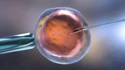 IVF