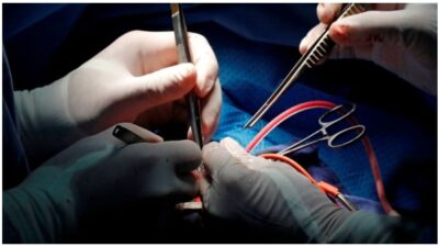 surgery
