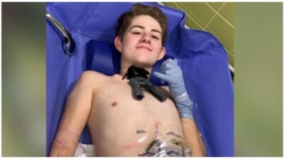 man loses half his body