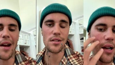 Justin Bieber facial parlysis - screenshot