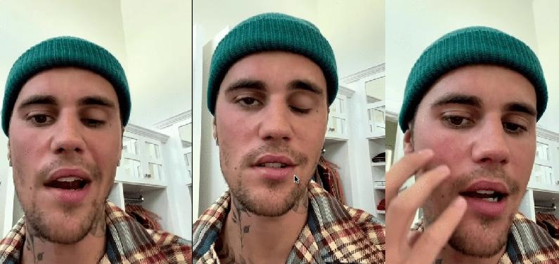Justin Bieber facial parlysis - screenshot