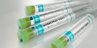 The Monkeypox Health Crisis: How California Is Responding