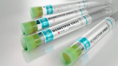 The Monkeypox Health Crisis: How California Is Responding