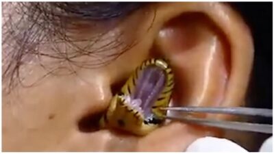 snake-stuck-ear
