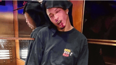 Viral Video Supports August Alsina's Claim He Was Attacked by Tory Lanez | Watch