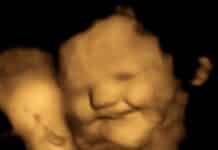 Fetus smiling (FETAP Study-Fetal and Neonatal Research Lab-Durham University)