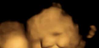 Fetus smiling (FETAP Study-Fetal and Neonatal Research Lab-Durham University)