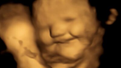 Fetus smiling (FETAP Study-Fetal and Neonatal Research Lab-Durham University)