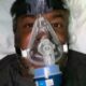Cedric Ceballos, suffering from COVID-19, tweets a photo of himself from the ICU