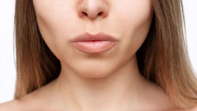 Buccal fat removal (Marina Demeshko-Adobe Stock) hypatia-h_c3f8d55c9df1ecd94b110de961b16bb8-h_b75c1f37d664527db564e
