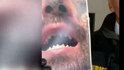 Michael Barajas' Filed Teeth - GENESEE CO Sheriff's Dept