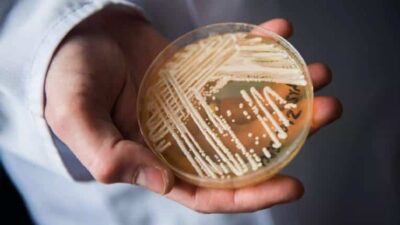 Deadly Drug Resistant Fungus - Getty