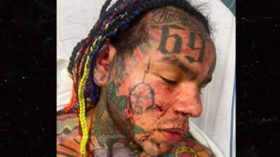 Tekashi 6ix9ine in hospital after beating - via TMZ