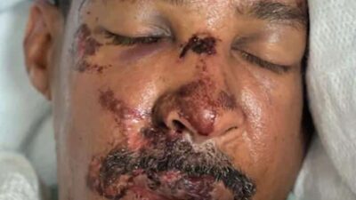 Craig Landry - via GoFundMe