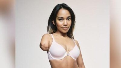 Victoria's Secret model amputated