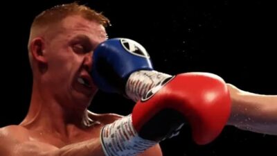 Boxer gets hit in face - Getty