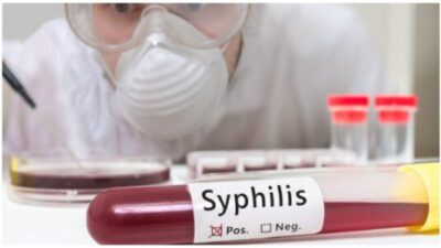 Syphilis