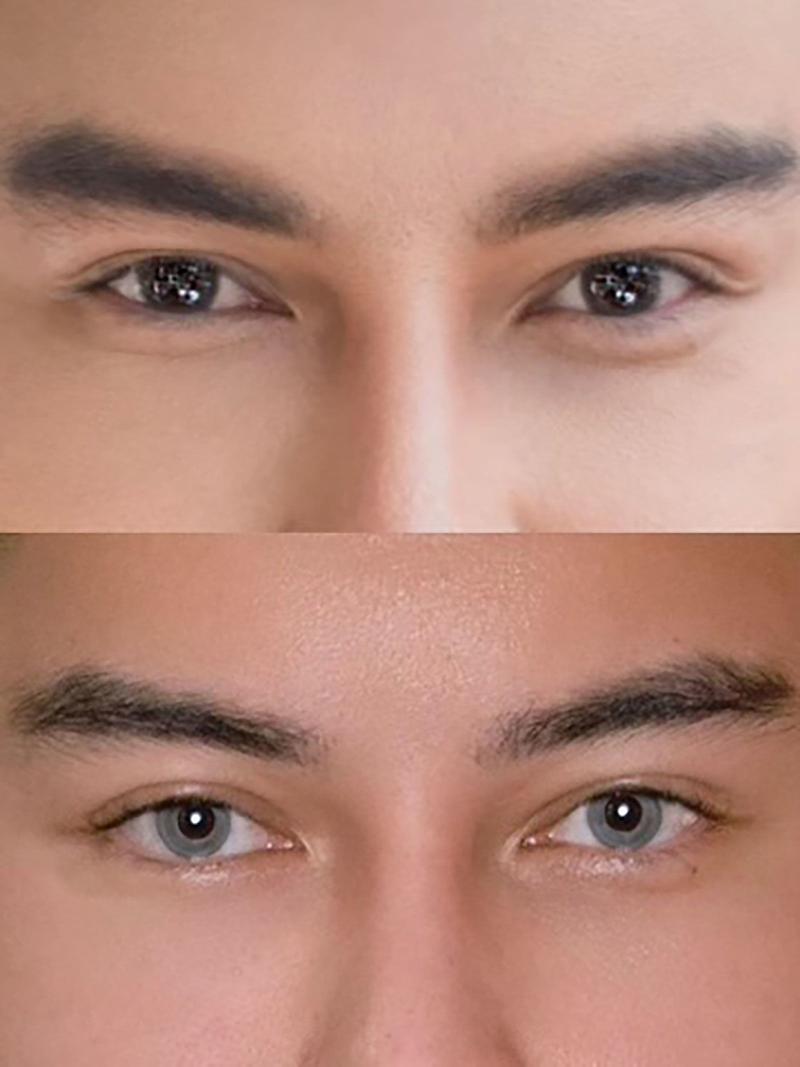  Eye color surgery is risky, but it's overtaken colored contacts // Jack Titus (Courtesy Jack Titus via CNN Newsource) 