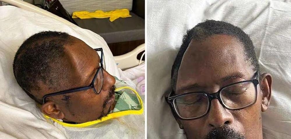 Fernando Cluster and wife sue hospital for losing part of his skull // Fernando Cluster - courtesy of the Cluster family