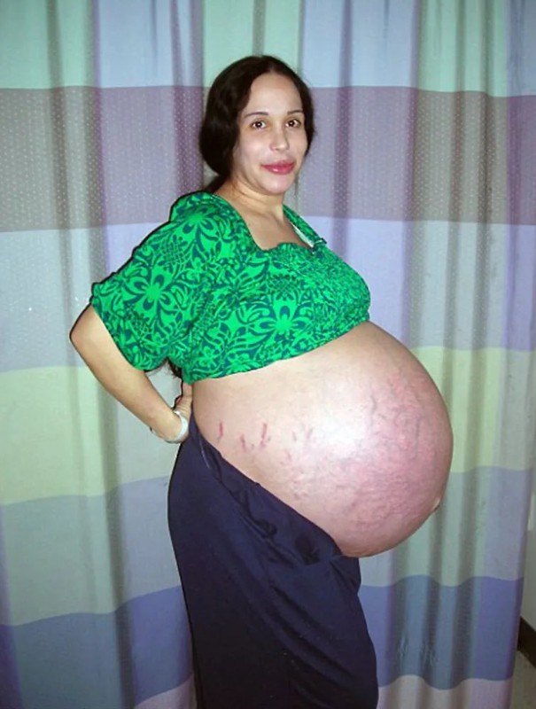 Octomom Natalie Suleman