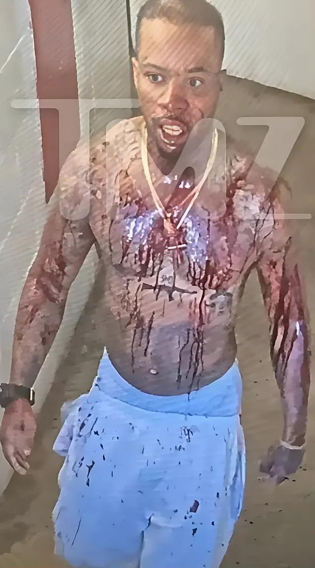 Tory Lanez covered in blood after stabbing