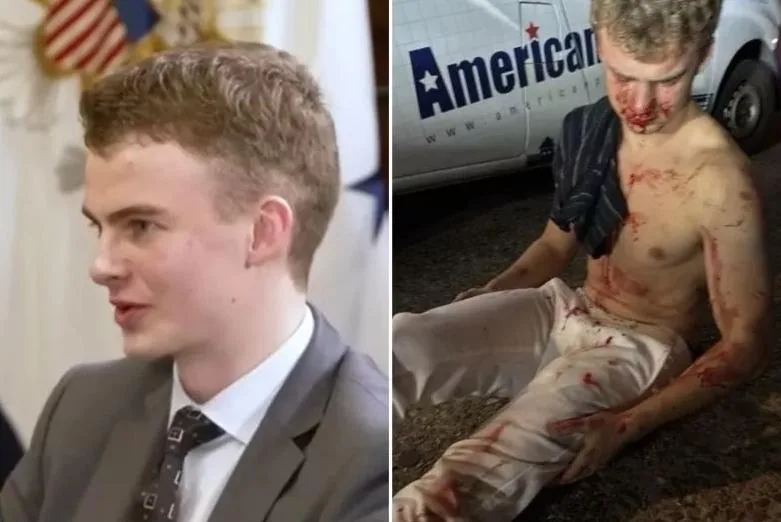 Big Balls beat up by DC teens