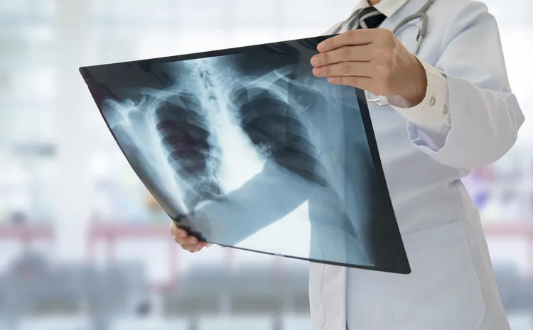 Doctor x-ray stock photo
