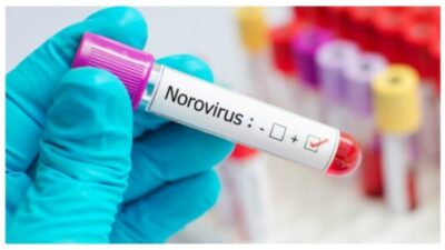 Norovirus