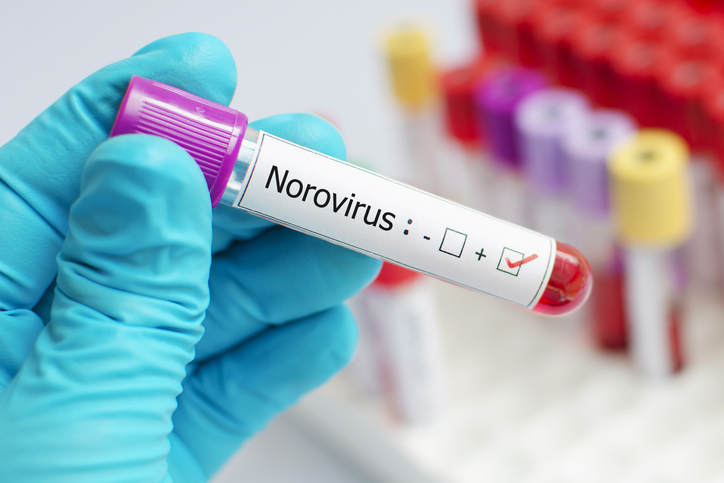 Norovirus 