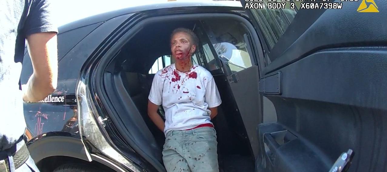 Video Shows Officer Slam Teen, Lawsuit Claims