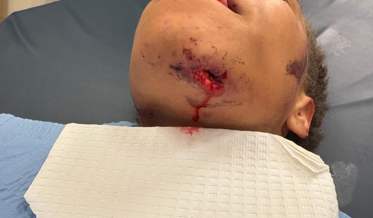 Erin Cowser after being body-slammed by cop - via bodycam footage2