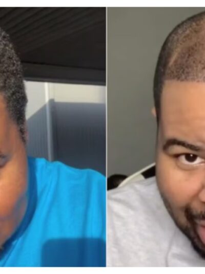&lsquo;90 Day Fianc&eacute;&rsquo; Star Shows Off Major Transformation After Weight Loss and Hair Transplant