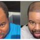&lsquo;90 Day Fianc&eacute;&rsquo; Star Shows Off Major Transformation After Weight Loss and Hair Transplant