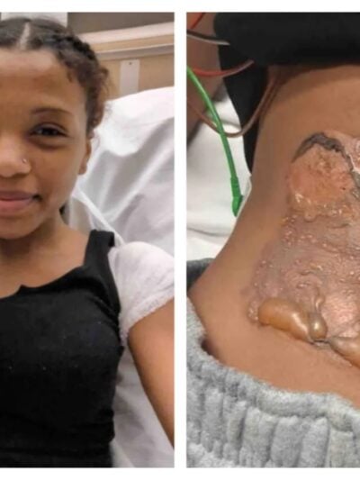Bakersfield freshman Bridgette Chocoteco suffered second- and third-degree burns after being restrained on a sun-heated metal utility plate.