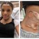 Bakersfield freshman Bridgette Chocoteco suffered second- and third-degree burns after being restrained on a sun-heated metal utility plate.