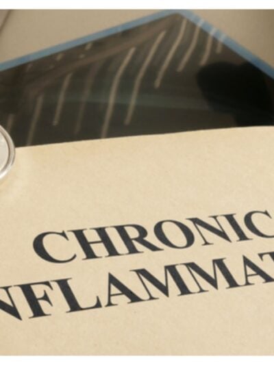 Chronic Inflammation is shown using the text as medical concept stock photo